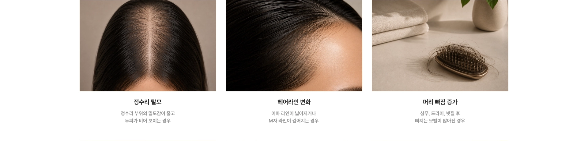 정수리 탈모, 헤어라인 변화, 머리 빠짐 증가