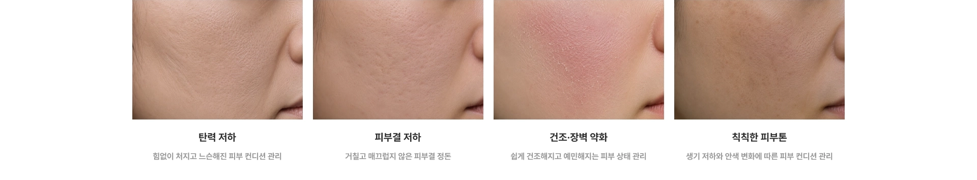 피부 케어 : 탄력 저하, 피부결 저하, 건조·장벽 약화, 칙칙한 피부톤