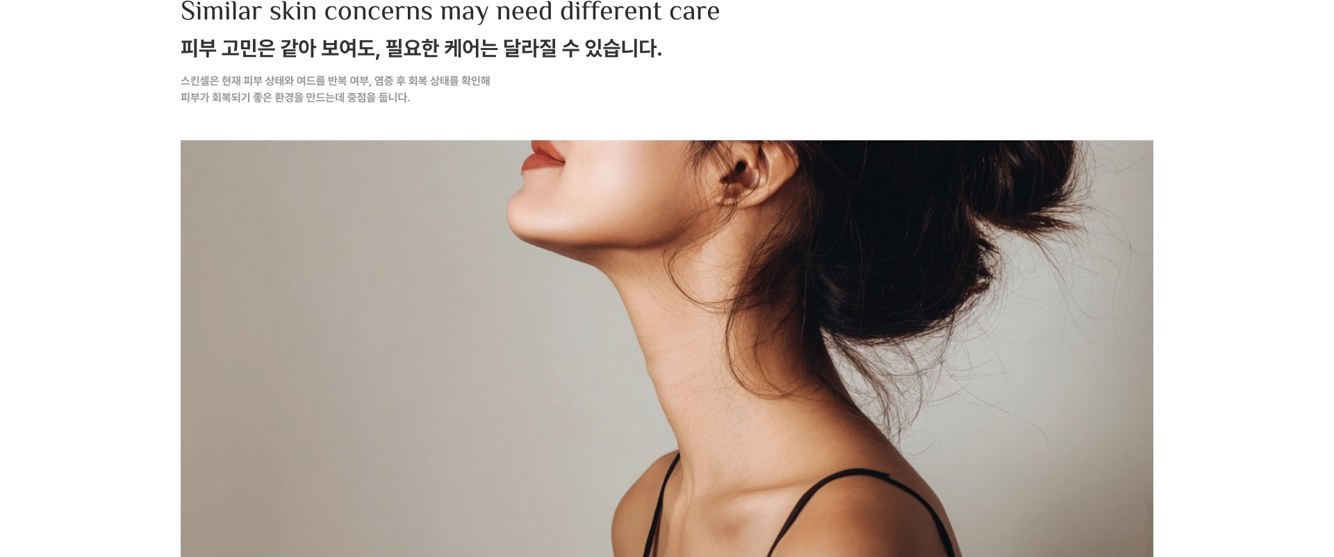 Similar skin concerns may need different care. 피부 고민은 같아 보여도, 필요한 케어는 달라질 수 있습니다. 스킨셀은 현재 피부 상태와 여드름 반복 여부, 염증 후 회복 상태를 확인해 피부가 회복되기 좋은 환경을 만드는데 중점을 둡니다.