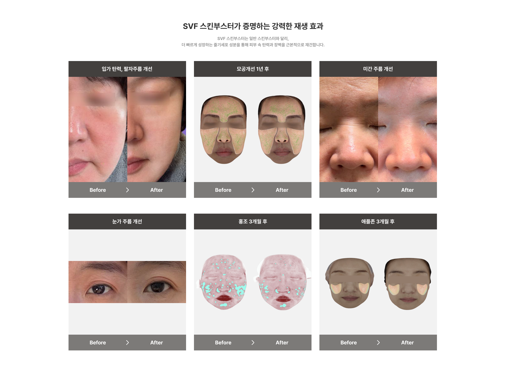 SVF 스킨부스터가 증명하는 강력한 재생 효과